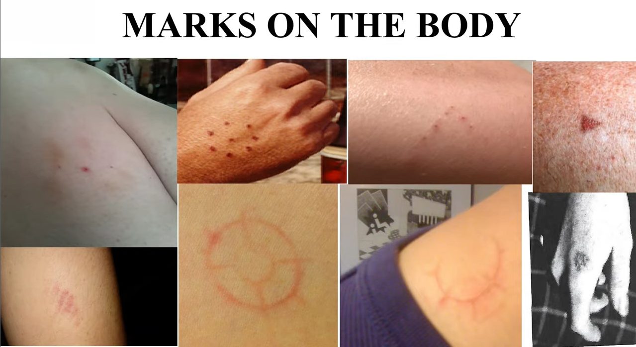 gh_20250518_mark_body.jpg