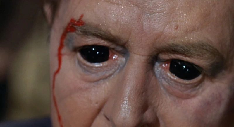 gh_20250611_xray_eye.jpg