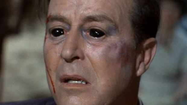 gh_20250611_xray_eye2.jpg